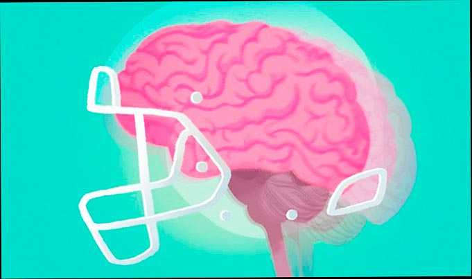 Ilustración del cerebro en el casco de la NFL